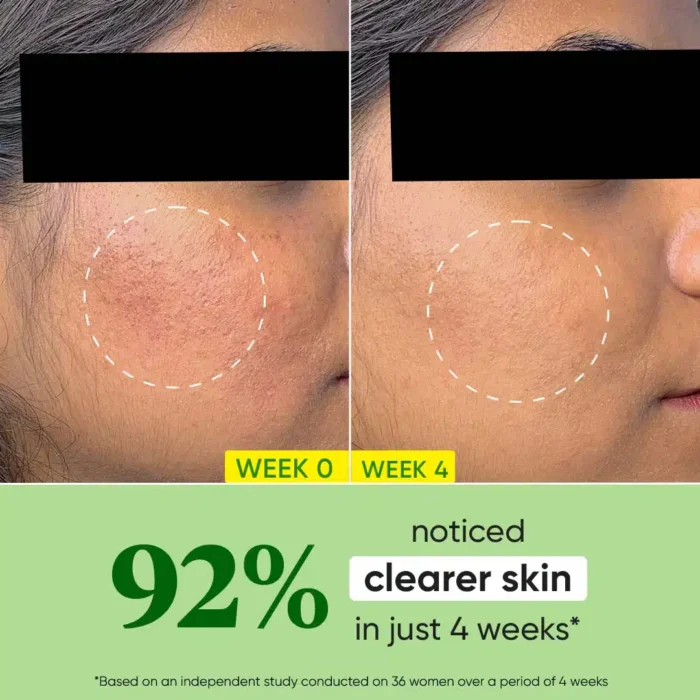 Dot & Key CICA +Niacinamide Oil - Free Moisturizer - Image 3