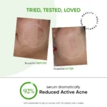 Dot & Key Cica + 2% Salicylic Skin Clearing Face Serum - 30ML - Image 3