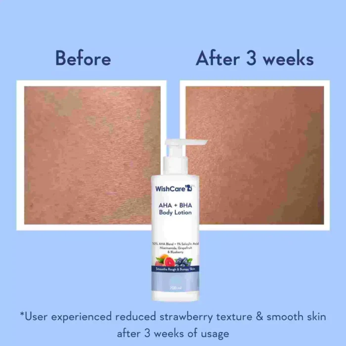 WishCare AHA + BHA Body Lotion - Image 5