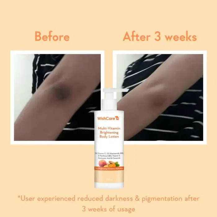 2 pc WishCare Multi Vitamin Brightening Body Lotion(2x 200ml) Expiry :09/26❗ - Image 7