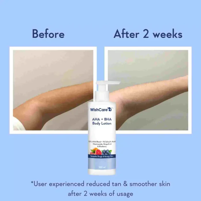 WishCare AHA + BHA Body Lotion - Image 4