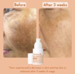 Super Bright Vitamin C16 Serum | 30ml - Image 4