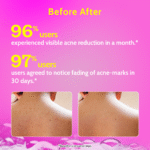 Chemist At Play Salicylic Acid Body Wash for Acne Control - 236 ml - Image 4