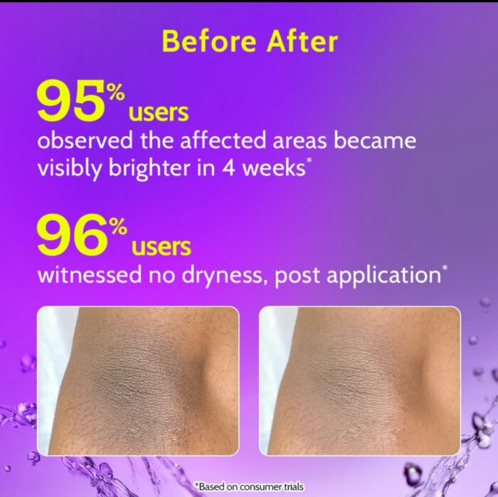 Chemist at Play Brightening & Whitening Roll On For Neck, Knee & Elbow | Exfoliates, Removes Pigmentation | 40ml - Image 4