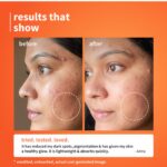 Plum 10% Vitamin C Glow + Barrier Boosting Serum with 3% Niacinamide, Calendula , 1% Hyaluronic acid & 1% Ceramide complex - Image 2