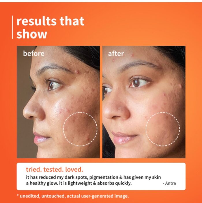 Plum 10% Vitamin C Glow + Barrier Boosting Serum with 3% Niacinamide, Calendula , 1% Hyaluronic acid & 1% Ceramide complex - Image 2