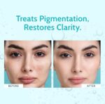 Chemist At Play's Clarifying Serum | 10% Niacinamide | Treats Hyperpigmentation, Minimizes Pores & Improves Skin Texture | 30ml - Image 5