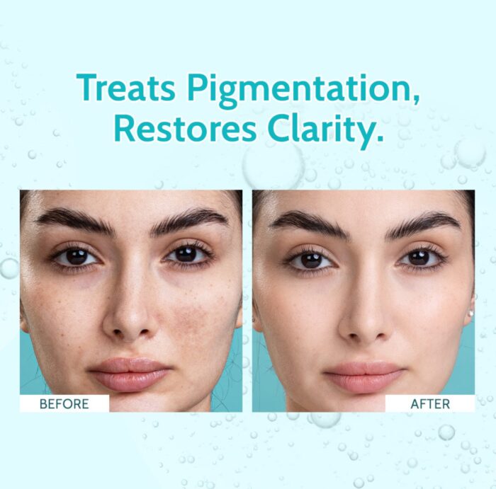 Chemist At Play's Clarifying Serum | 10% Niacinamide | Treats Hyperpigmentation, Minimizes Pores & Improves Skin Texture | 30ml - Image 5