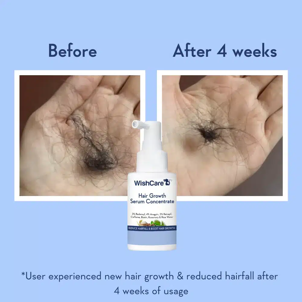 WishCare Hair Growth Serum-30ml - Image 4