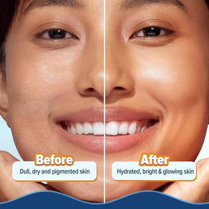 Aqualogica Glow+ Hydra Gel Moisturizer with Vitamin C for Glowing Skin (200 g) - Image 6