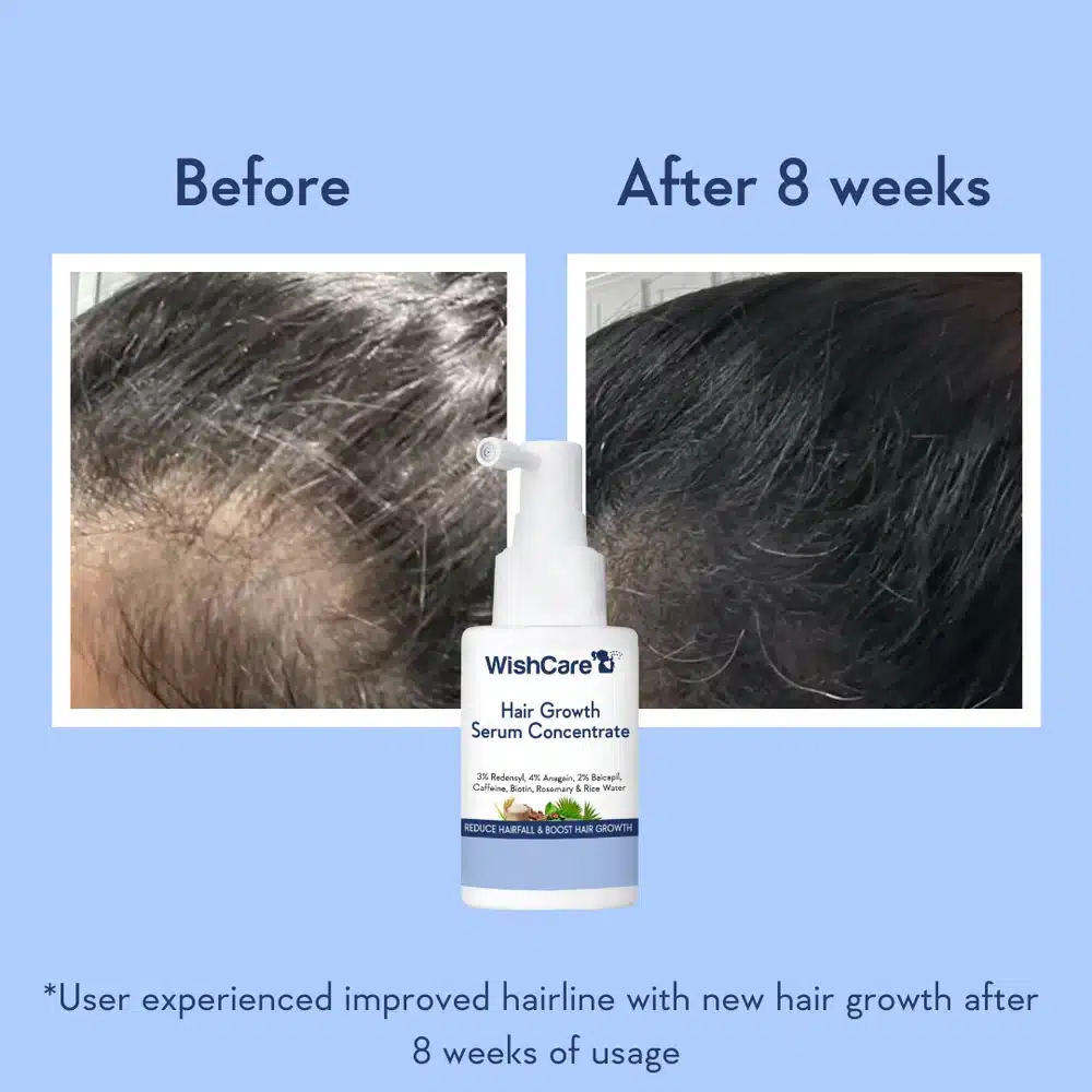 WishCare Hair Growth Serum-30ml - Image 5