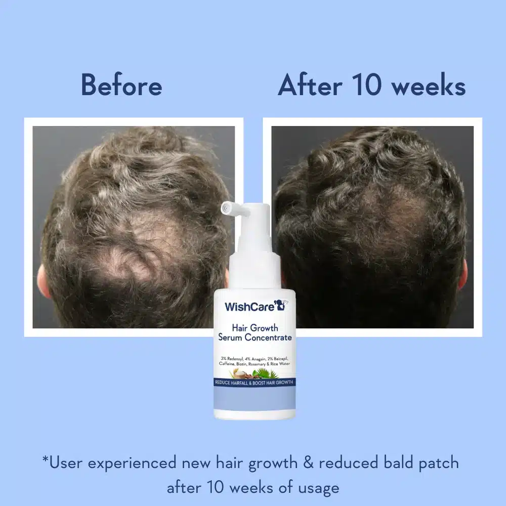 WishCare Hair Growth Serum-30ml - Image 9