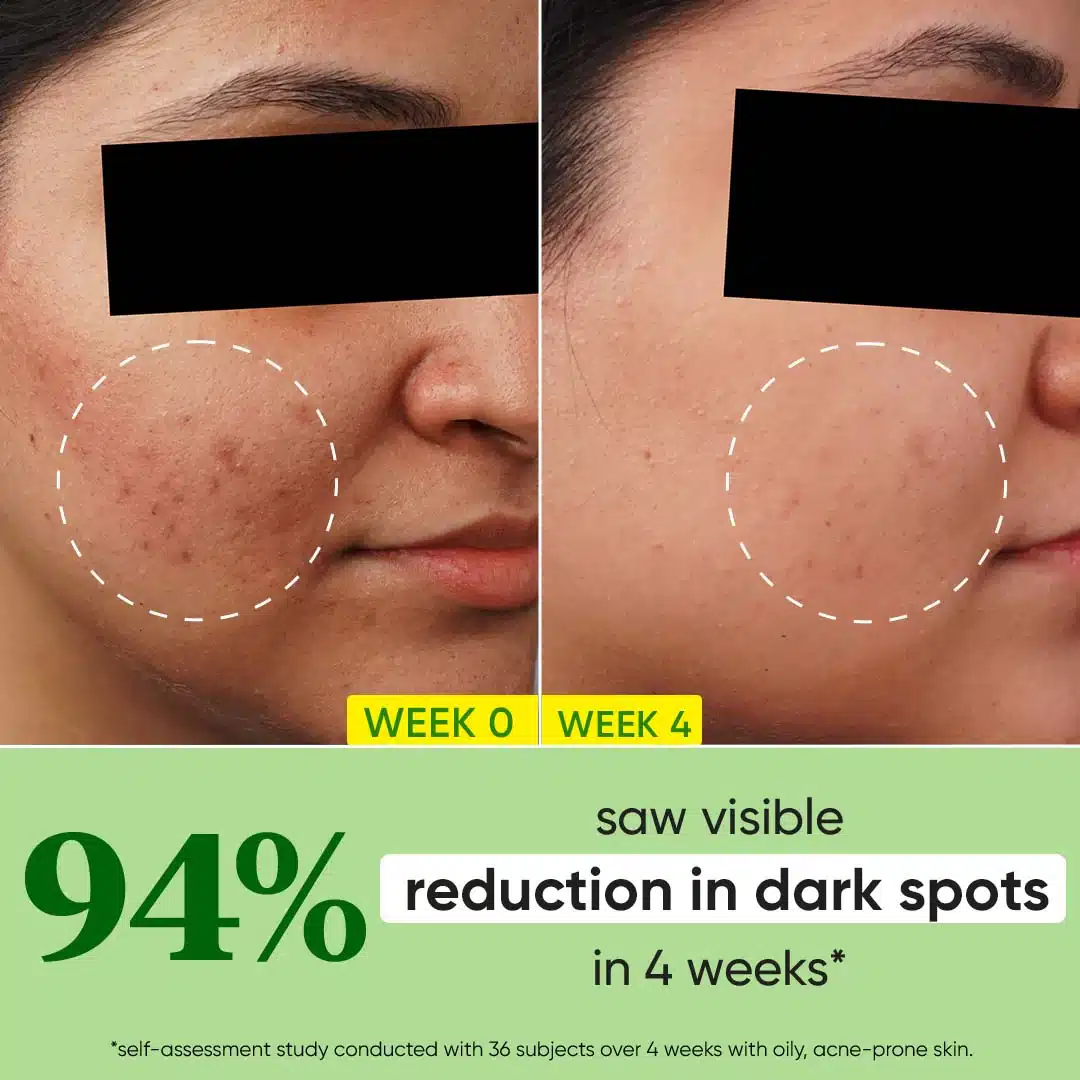 Dot & Key Cica + 10% Niacinamide Face Serum - Image 3