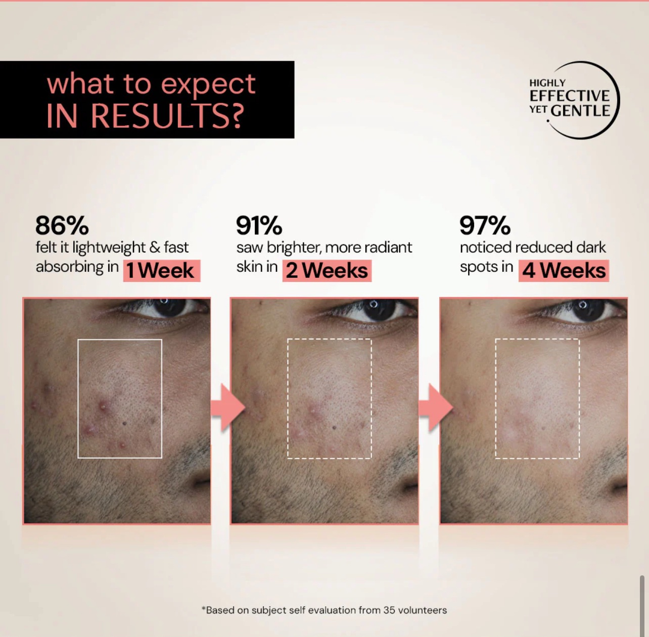 Deconstruct 5% Niacinamide Serum for Oily Skin + 2% Alpha Arbutin| | 30ML - Image 7