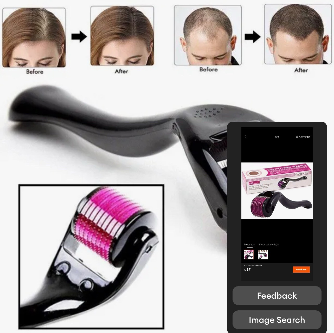 Derma Roller 0.5mm for Hair & Beard Growth – Micro Needles for Hair Regrowth - Image 2
